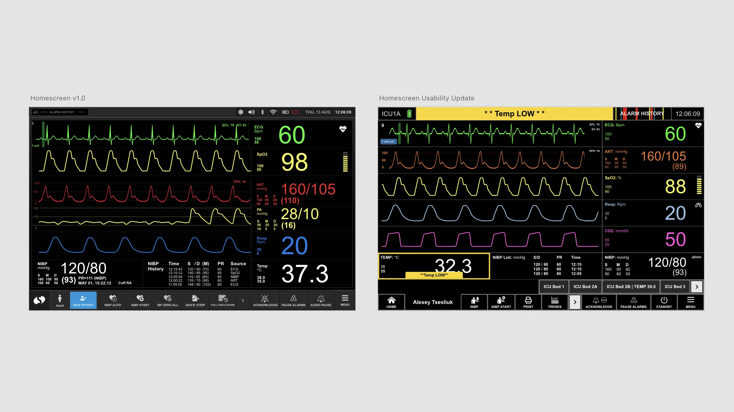 Rainer wireframes showing a configurable vital signs dashboard layout